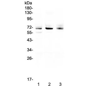 BEST1 / BEST / Bestrophin Antibody - Western blot testing of human 1) A549, 2) SGC-7901 and 3) U-2 OS cell lysate with Bestrophin 1 antibody at 0.5ug/ml. Predicted molecular weight ~68 kDa.