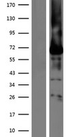 BEST1 / BEST / Bestrophin Protein - Western validation with an anti-DDK antibody * L: Control HEK293 lysate R: Over-expression lysate