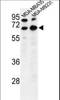 BEST2 / Bestrophin-2 Antibody - Western blot of BEST2 Antibody in MDA-MB435,MDA-MB231 cell line lysates (35 ug/lane). BEST2 (arrow) was detected using the purified antibody.