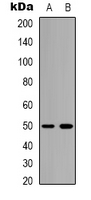 BEST2 / Bestrophin-2 Antibody - Western blot analysis of Bestrophin-2 expression in mouse brain (A); rat brain (B) whole cell lysates.