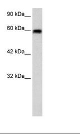 BEST4 Antibody - HepG2 Cell Lysate.  This image was taken for the unconjugated form of this product. Other forms have not been tested.