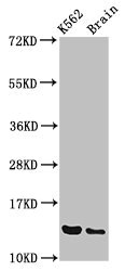 BET1 Antibody - Western Blot Positive WB detected in:K562 whole cell lysate,Rat brain tissue All Lanes:BET1 antibody at 3.4µg/ml Secondary Goat polyclonal to rabbit IgG at 1/50000 dilution Predicted band size: 14,10 KDa Observed band size: 14 KDa