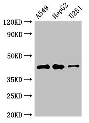 BET1 Antibody - Western Blot Positive WB detected in: A549 whole cell lysate, HepG2 whole cell lysate, U251 whole cell lysate All lanes: B4GALT2 antibody at 3.5µg/ml Secondary Goat polyclonal to rabbit IgG at 1/50000 dilution Predicted band size: 42, 35, 45 kDa Observed band size: 42 kDa