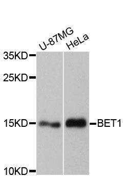 BET1 Antibody - Western blot analysis of extracts of various cell lines, using BET1 antibody at 1:3000 dilution. The secondary antibody used was an HRP Goat Anti-Rabbit IgG (H+L) at 1:10000 dilution. Lysates were loaded 25ug per lane and 3% nonfat dry milk in TBST was used for blocking. An ECL Kit was used for detection and the exposure time was 90s.
