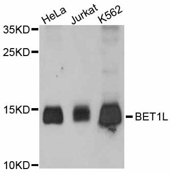 BET1L / GS15 Antibody - Western blot analysis of extracts of various cell lines, using BET1L antibody at 1:3000 dilution. The secondary antibody used was an HRP Goat Anti-Rabbit IgG (H+L) at 1:10000 dilution. Lysates were loaded 25ug per lane and 3% nonfat dry milk in TBST was used for blocking. An ECL Kit was used for detection and the exposure time was 90s.