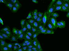 BET1L / GS15 Antibody - Immunofluorescence staining of BET1L in U2OS cells. Cells were fixed with 4% PFA, permeabilzed with 0.1% Triton X-100 in PBS, blocked with 10% serum, and incubated with rabbit anti-Human BET1L polyclonal antibody (dilution ratio 1:100) at 4°C overnight. Then cells were stained with the Alexa Fluor 488-conjugated Goat Anti-rabbit IgG secondary antibody (green) and counterstained with DAPI (blue). Positive staining was localized to Cytoplasm.