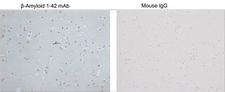 Beta Amyloid 1-42 Antibody - Immunohistochemistry analysis of human brain tissue slide (Paraffin embedded) using Human ß-Amyloid 1-42 Antibody (2C2G5), mAb, Mouse and Mouse IgG Control (Whole Molecule), Purified.