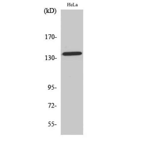 Beta Amyloid Antibody - Western blot of Phospho-Amyloid-beta (T743) antibody