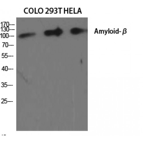 Beta Amyloid Antibody - Western blot of Amyloid-beta antibody