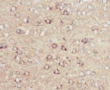 Beta Amyloid Antibody - IHC-P: Amyloid beta antibody testing of mouse brain tissue
