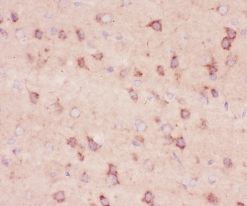 Beta Amyloid Antibody - IHC-P testing of rat brain tissue