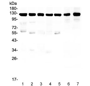 Beta Amyloid Antibody - Western blot testing of Amyloid beta antibody and Lane 1: rat brain; 2: mouse brain lysate. Expected/observed size: 87~120 depending on glycosylation level
