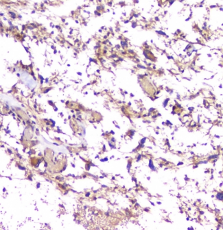 Beta Amyloid Antibody - IHC-P: Amyloid beta antibody testing of mouse brain tissue. HIER: steamed with pH6 citrate buffer.