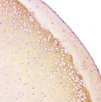 Beta Amyloid Antibody - IHC-P testing of rat brain tissue. HIER: steamed with pH6 citrate buffer.