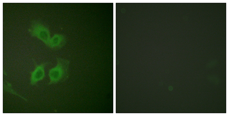 Beta Amyloid Antibody - Immunofluorescence analysis of HeLa cells, using Amyloid beta A4 Antibody. The picture on the right is blocked with the synthesized peptide.