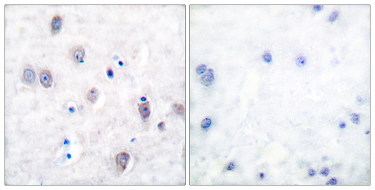 Beta Amyloid Antibody - Immunohistochemistry analysis of paraffin-embedded human brain, using Amyloid beta A4 Antibody. The picture on the right is blocked with the synthesized peptide.