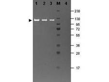 Beta Galactosidase Antibody - Anti-B-Galactosidase Antibody - Western Blot. Western blotting using Fluorescein conjugated anti-b-Galactosidase antibody shows a band at ~117 kD (lanes 1 - 3) corresponding to 60 ng, 30 ng and 15 ng, respectively of b-Gal present in partially purified preparations (arrowhead). Lane 4 shows no cross reactivity with proteins present in a non-specific control E. coli lysate. Proteins were resolved on a 4-20% Tris-Glycine gel by SDS-PAGE and transferred to nitrocellulose and blocking using Blocking Buffer for Fluorescent Western Blot. The membrane was probed with fluorescein conjugated anti-b-Galactosidase ( diluted to 1:10000. Reaction occurred for 2 hours at room temperature. Molecular weight estimation was made by comparison to a prestained MW marker in lane M. Fluorescence image was captured using the VersaDoc Imaging System developed by BIO-RAD. Other detection systems will yield similar results.
