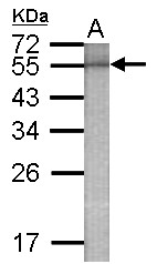 Beta Galactosidase Antibody - Western blot experiment using Beta-gal Antibody  at 1:90000 dilution to detect 100ng of 55kDa recombinant Beta-gal protein antigen.
