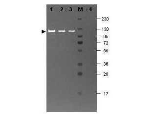 Beta Galactosidase Antibody - Western blotting using Fluorescein conjugated anti-beta-Galactosidase antibody shows a band at ~117 kDa (lanes 1-3) corresponding to 60 ng, 30 ng and 15 ng, respectively of beta-Galactosidase present in partially purified preparations (arrowhead). Lane 4 shows no cross reactivity with proteins present in a non-specific control E.coli lysate. Proteins were resolved on a 4-20% Tris-Glycine gel by SDS-PAGE and transferred to nitrocellulose and blocking using Blocking Buffer for Fluorescent Western Blotting. The membrane was probed with fluorescein conjugated anti-b-Galactosidase diluted to 1:10000. Reaction occurred for 2 hours at room temperature. Molecular weight estimation was made by comparison to a prestained MW marker in lane M. Fluorescence image was captured using the VersaDoc Imaging System developed by BIO-RAD. Other detection systems will yield similar results.