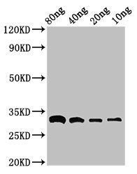 Beta-Lactamase CTX-M-1 Antibody - Positive Western Blot detected in Recombinant protein All lanes bla antibody at 3 µg/ml Secondary Goat polyclonal to rabbit IgG at 1/50000 dilution. Predicted band size: 33 KDa. Observed band size: 33 KDa