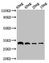Beta-Lactamase CTX-M-1 Antibody - Positive Western Blot detected in Recombinant protein All lanes bla antibody at 3 µg/ml Secondary Goat polyclonal to rabbit IgG at 1/50000 dilution. Predicted band size: 33 KDa. Observed band size: 33 KDa