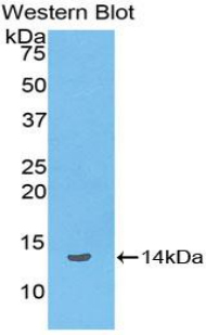 Beta Lipotropin Antibody - Western blot of recombinant Beta Lipotropin.  This image was taken for the unconjugated form of this product. Other forms have not been tested.