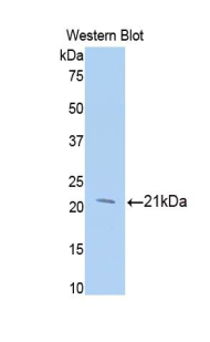 Beta-N-Acetylglucosaminidase Antibody - Western blot of recombinant O-GlcNAcase / MGEA5.  This image was taken for the unconjugated form of this product. Other forms have not been tested.