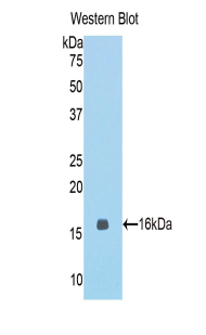 Beta-N-Acetylglucosaminidase Antibody - Western blot of recombinant O-GlcNAcase / MGEA5.  This image was taken for the unconjugated form of this product. Other forms have not been tested.