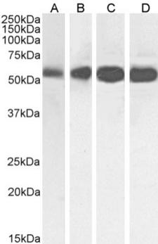 Beta Tubulin Antibody - IF staining of HeLa cells.
