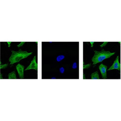 Beta Tubulin Antibody - Immunofluorescence of beta-tubulin antibody