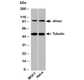 Beta Tubulin Antibody - Western blot testing of human samples with beta Tubulin antibody at 2ug/ml.