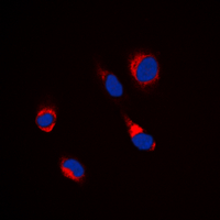 Beta Tubulin Antibody - Immunofluorescent analysis of Beta-tubulin staining in Jurkat cells. Formalin-fixed cells were permeabilized with 0.1% Triton X-100 in TBS for 5-10 minutes and blocked with 3% BSA-PBS for 30 minutes at room temperature. Cells were probed with the primary antibody in 3% BSA-PBS and incubated overnight at 4 deg C in a humidified chamber. Cells were washed with PBST and incubated with a DyLight 594-conjugated secondary antibody (red) in PBS at room temperature in the dark. DAPI was used to stain the cell nuclei (blue).