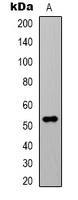 Beta Tubulin Antibody - Western blot analysis of Alpha-tubulin (AcK40) expression in HeLa (A) whole cell lysates.