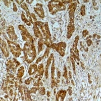 Beta Tubulin Antibody - Immunohistochemical analysis of Alpha-tubulin (AcK40) staining in human breast cancer;mouse brain formalin fixed paraffin embedded tissue section. The section was pre-treated using heat mediated antigen retrieval with sodium citrate buffer (pH 6.0). The section was then incubated with the antibody at room temperature and detected using an HRP conjugated compact polymer system. DAB was used as the chromogen. The section was then counterstained with hematoxylin and mounted with DPX.