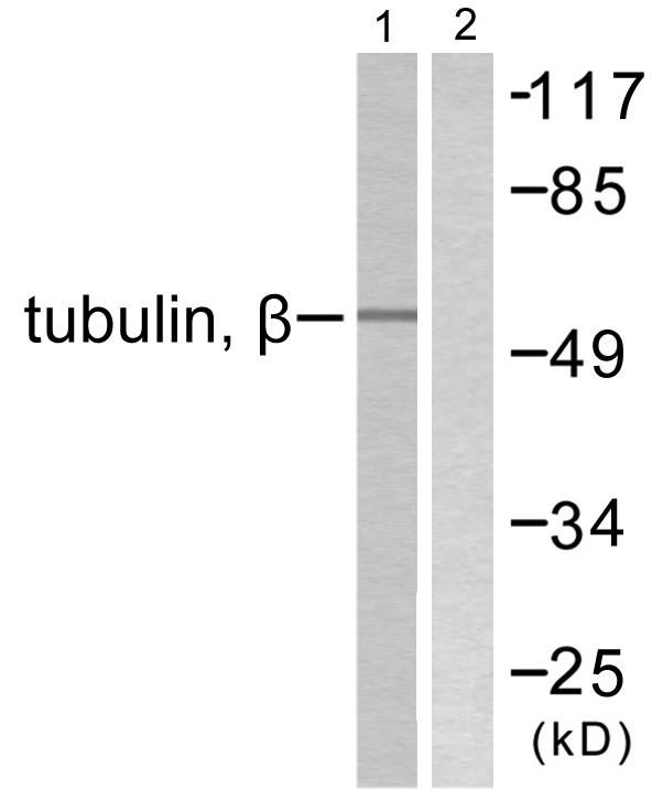 Beta Tubulin Antibody - Western blot analysis of extracts from mouse brain cells, using Tubulin ß antibody.