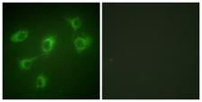 Betaglycan / TGFBR3 Antibody - Immunofluorescence analysis of HUVEC cells, using TGF beta Receptor III Antibody. The picture on the right is blocked with the synthesized peptide.