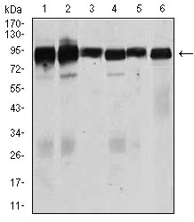 Betaglycan / TGFBR3 Antibody - Western blot using TGFBR3 mouse monoclonal antibody against Jurkat (1), HeLa (2), MCF-7 (3), F9 (4), SK-N-SH (5), and NIH3T3 (6) cell lysate.