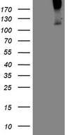Betaglycan / TGFBR3 Antibody - HEK293T cells were transfected with the pCMV6-ENTRY control. (Left lane) or pCMV6-ENTRY TGFBR3. (Right lane) cDNA for 48 hrs and lysed
