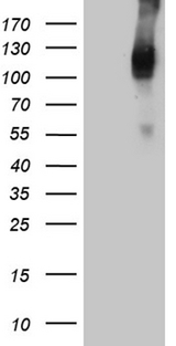Betaglycan / TGFBR3 Antibody - HEK293T cells were transfected with the pCMV6-ENTRY control. (Left lane) or pCMV6-ENTRY TGFBR3. (Right lane) cDNA for 48 hrs and lysed. Equivalent amounts of cell lysates. (5 ug per lane) were separated by SDS-PAGE and immunoblotted with anti-TGFBR3. (1:500)