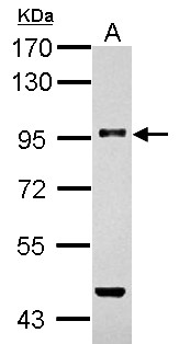 Betaglycan / TGFBR3 Antibody - Sample (30 ug of whole cell lysate). A: THP-1. 7.5% SDS PAGE. Betaglycan / TGFBR3 antibody diluted at 1:1000.