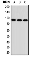 Betaglycan / TGFBR3 Antibody - Western blot analysis of TGFBR3 expression in HEK293T (A); Raw264.7 (B); PC12 (C) whole cell lysates.