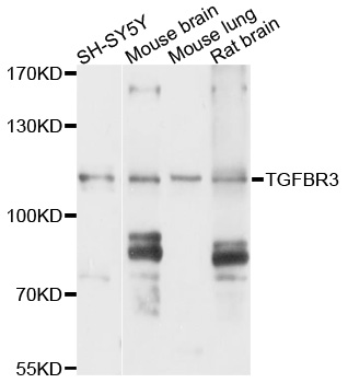Betaglycan / TGFBR3 Antibody - Western blot analysis of extracts of various cell lines, using TGFBR3 antibody at 1:1000 dilution. The secondary antibody used was an HRP Goat Anti-Rabbit IgG (H+L) at 1:10000 dilution. Lysates were loaded 25ug per lane and 3% nonfat dry milk in TBST was used for blocking. An ECL Kit was used for detection and the exposure time was 10s.