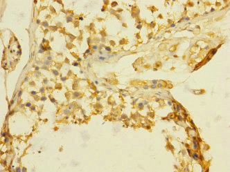 Betaglycan / TGFBR3 Antibody - Immunohistochemistry of paraffin-embedded human testis tissue at dilution 1:100