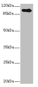 Betaglycan / TGFBR3 Antibody - Western blot All Lanes: TGFBR3 antibody IgG at 2.39ug/ml+ Hela whole cell lysate Secondary Goat polyclonal to rabbit IgG at 1/10000 dilution Predicted band size: 93 kDa Observed band size: 93 kDa