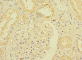 Betaglycan / TGFBR3 Antibody - Immunohistochemistry of paraffin-embedded human kidney tissue at dilution 1:100