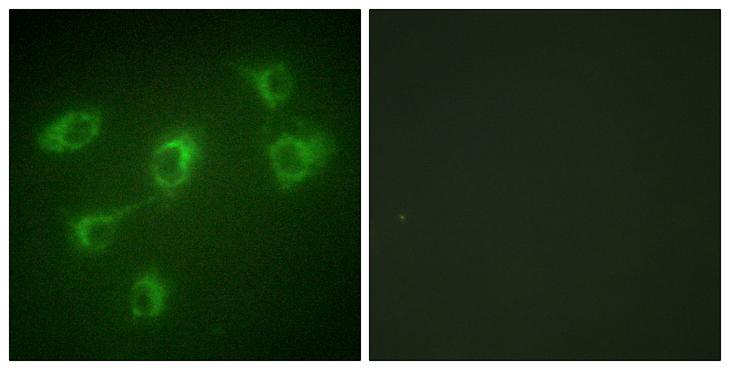 Betaglycan / TGFBR3 Antibody - Peptide - + Immunofluorescence analysis of HuvEc cells, using TGF ß Receptor III antibody.