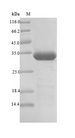 Major pollen allergen Bet v 1-A Protein - (Tris-Glycine gel) Discontinuous SDS-PAGE (reduced) with 5% enrichment gel and 15% separation gel.