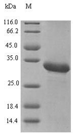 Profilin Protein - (Tris-Glycine gel) Discontinuous SDS-PAGE (reduced) with 5% enrichment gel and 15% separation gel.