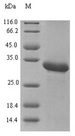Profilin Protein - (Tris-Glycine gel) Discontinuous SDS-PAGE (reduced) with 5% enrichment gel and 15% separation gel.