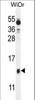 BEX1 Antibody - BEX1 Antibody western blot of WiDr cell line lysates (35 ug/lane). The BEX1 antibody detected the BEX1 protein (arrow).